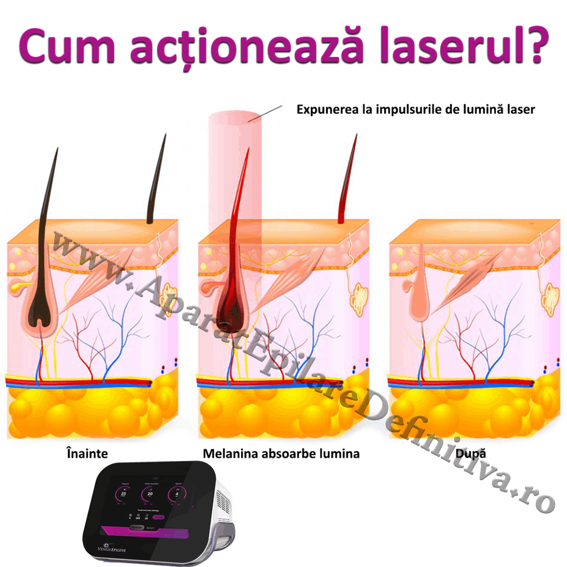 Cum acționează laserul